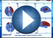 Feature segment on Neurofeedback from WGN-TV in Chicago, Il.