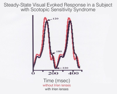 Steady-state visual evoked response in a subject with Scotopic Sensitivity Syndrome.