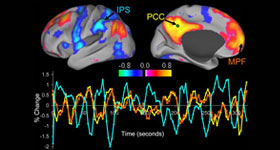 Functional Magnetic Resonance Neurofeedback