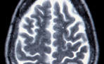 head_injury