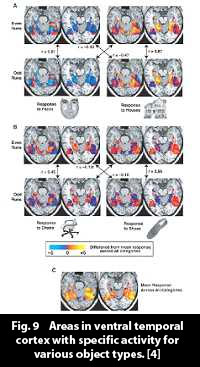 temporal_cortex